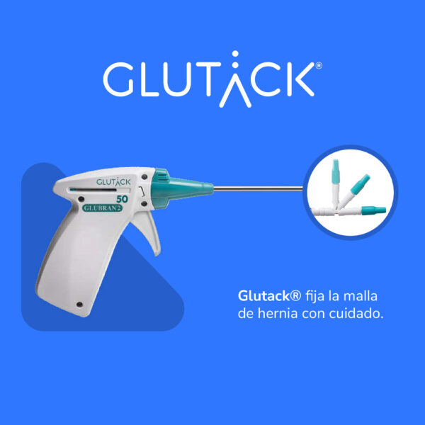 Glutack 30® para Fijación Atraumática de Malla Laparoscópica + Glubran® 2 (0.5 ml) | Kit Adhesivo Quirúrgico - Imagen 3